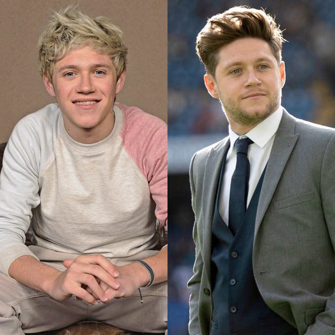 Niall Horan poses then and now